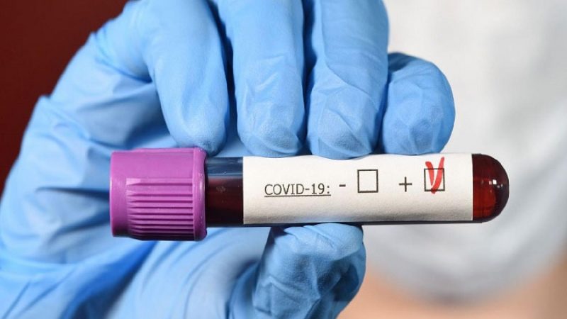 تسجيل 243 حالة إصابة مؤكدة جديدة بفيروس كورونا المستجد خلال 24ساعة بالمغرب