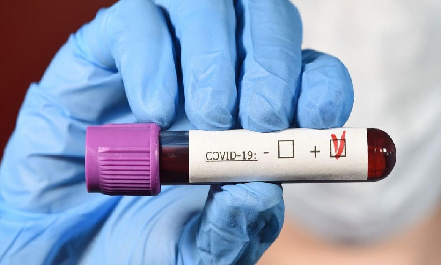 رصد 186 إصابة جديدة مؤكدة بفيروس كورونا خلال الـ16 ساعة الماضية بالمغرب