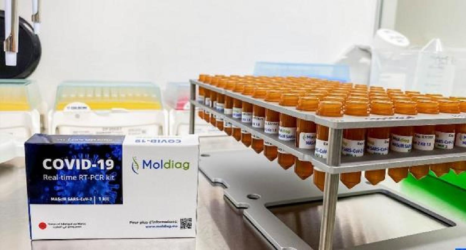 الشروع في إنتاج أول طقم تشخيص لفيروس كوفيد-19 مغربي مائة في المائة