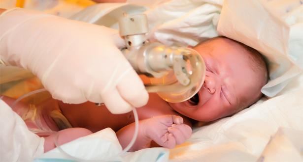 إجراء أول تقنية بالمغرب لعلاج اختناق حديثي الولادة بمراكش