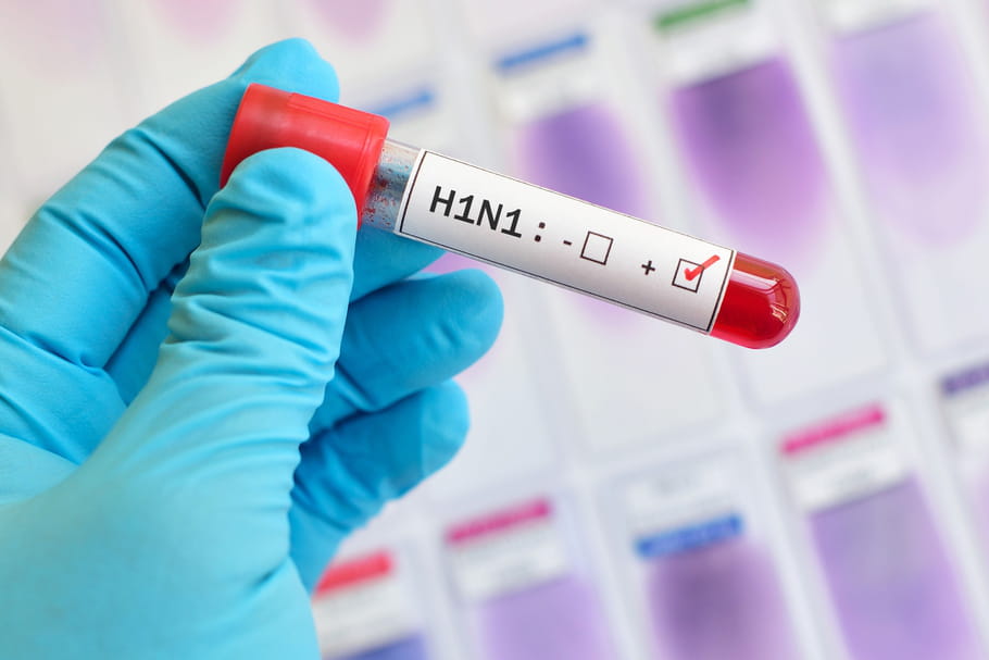 كندا.. أول إصابة بشرية بنوع نادر من إنفلونزا الخنازير