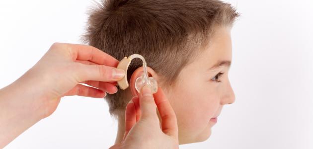 توزيع سماعات طبية على ضعاف السمع بالحوز