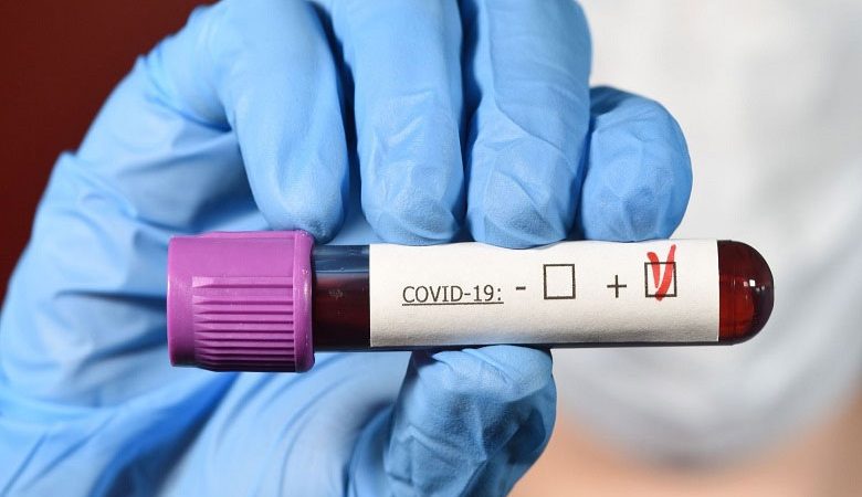 تسجيل 3 حالات جديدة مؤكدة بفيروس كورونا بالحوز