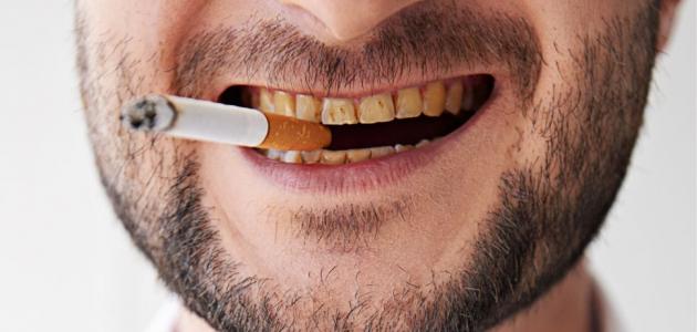 الحمضيات وقضم الأظافر والتدخين.. 7 عادات يومية تدمر أسنانك