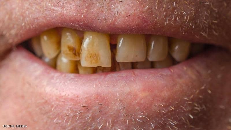 اٍصفرار الأسنان يجلب مشروعا حيويا الى مولاي براهيم بقيمة أزيد من ملياري سنيتم