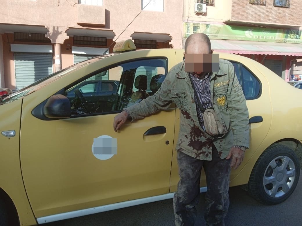 نقل سائق طاكسي صغير في حالة حرجة إلى المستعجلات بعد تعرضه لاعتداء بالسعادة