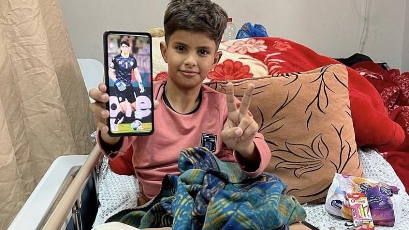 بونو يحقق حلم طفل فلسطيني بعدما بترت إحدى رجليه